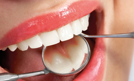 Controllo dal dentista: ogni quanto sarebbe bene farlo?