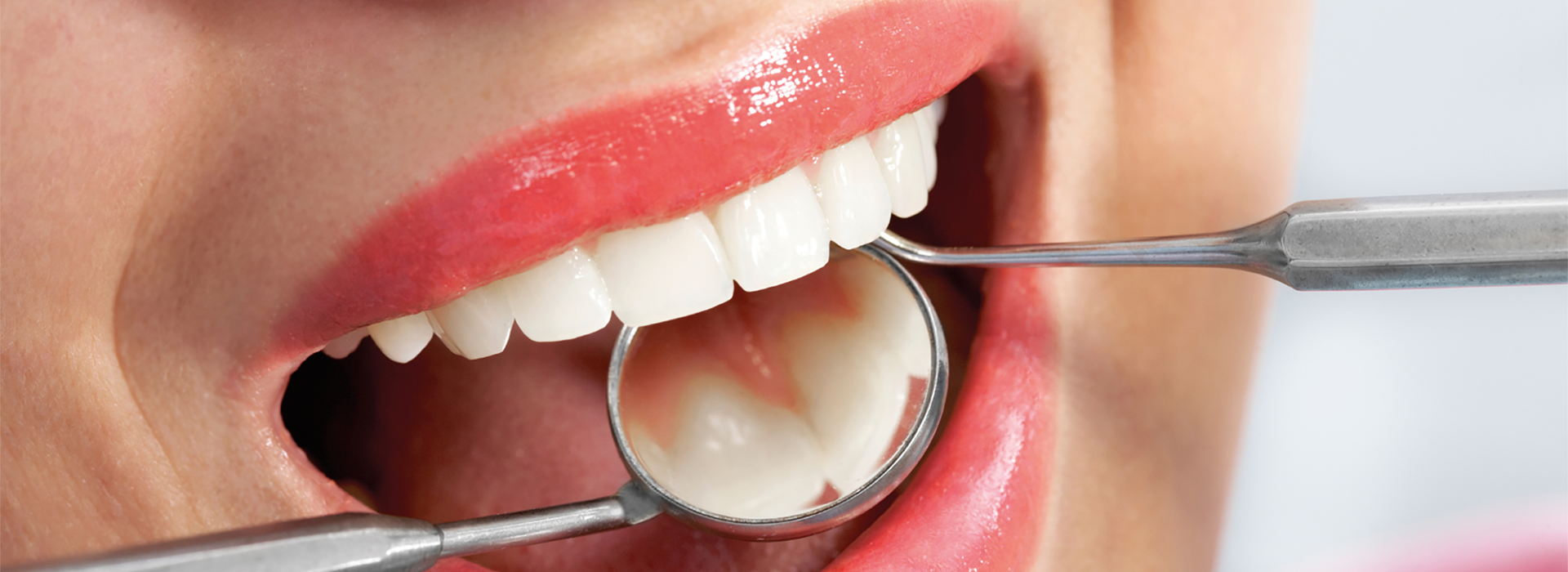 Controllo dal dentista: ogni quanto sarebbe bene farlo?