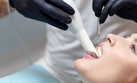L’impronta dentale ora è digitale grazie allo scanner intra-orale