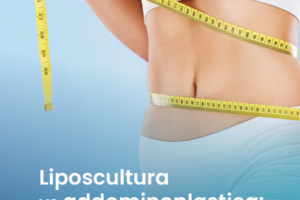 Chirurgia Estetica: Liposcultura moderna o Addominoplastica come spinta estiva