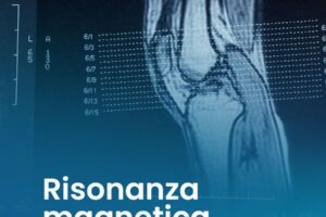 Come prepararsi alla risonanza magnetica: regole e consigli utili
